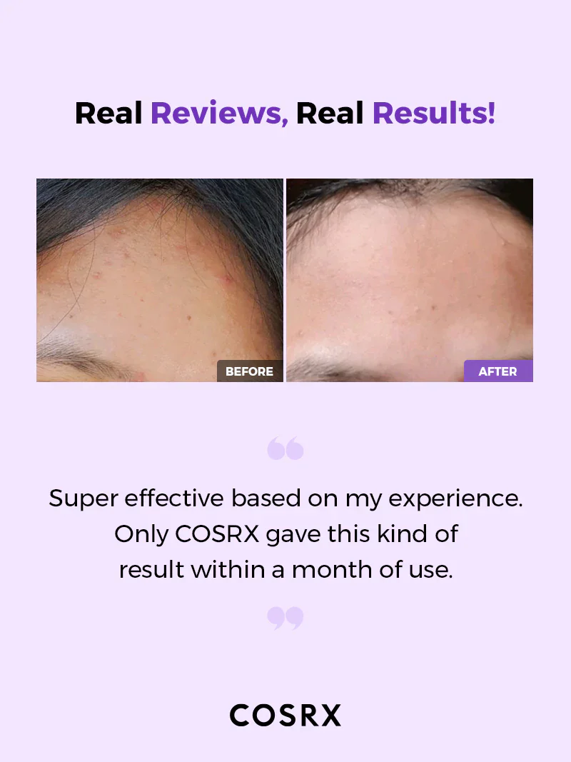 Cosrx AHA/BHA Clarifying  Treatment Toner - Image 4