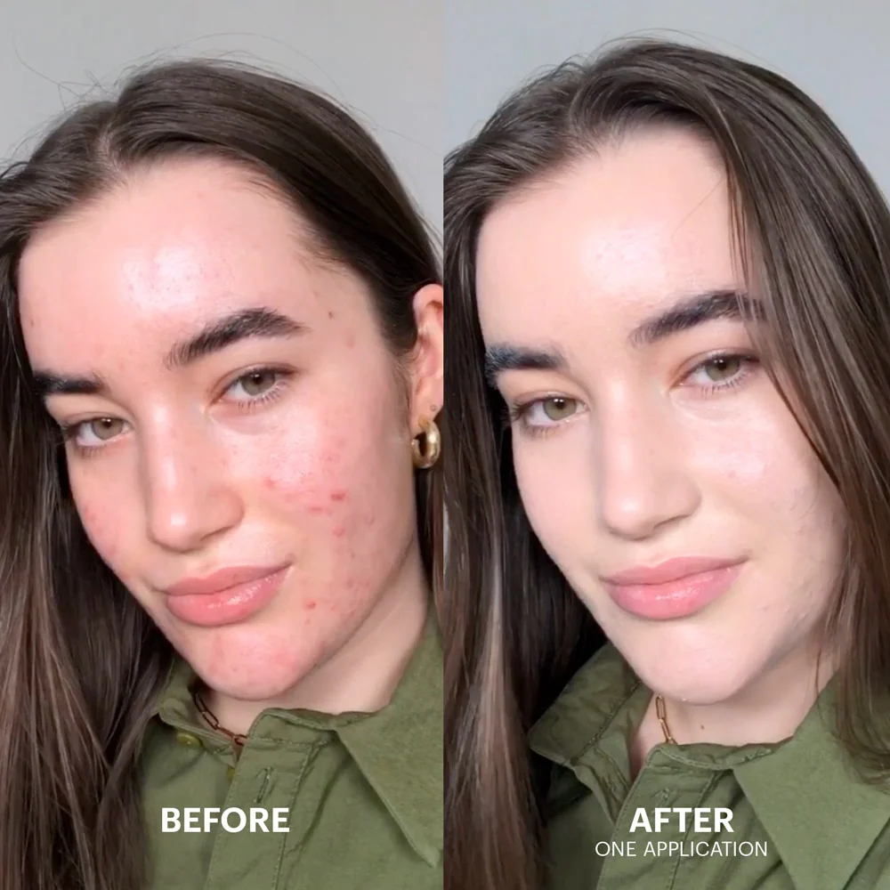Dr.Jart+ Tiger Grass Color Correcting Treatment 50ml - Image 3