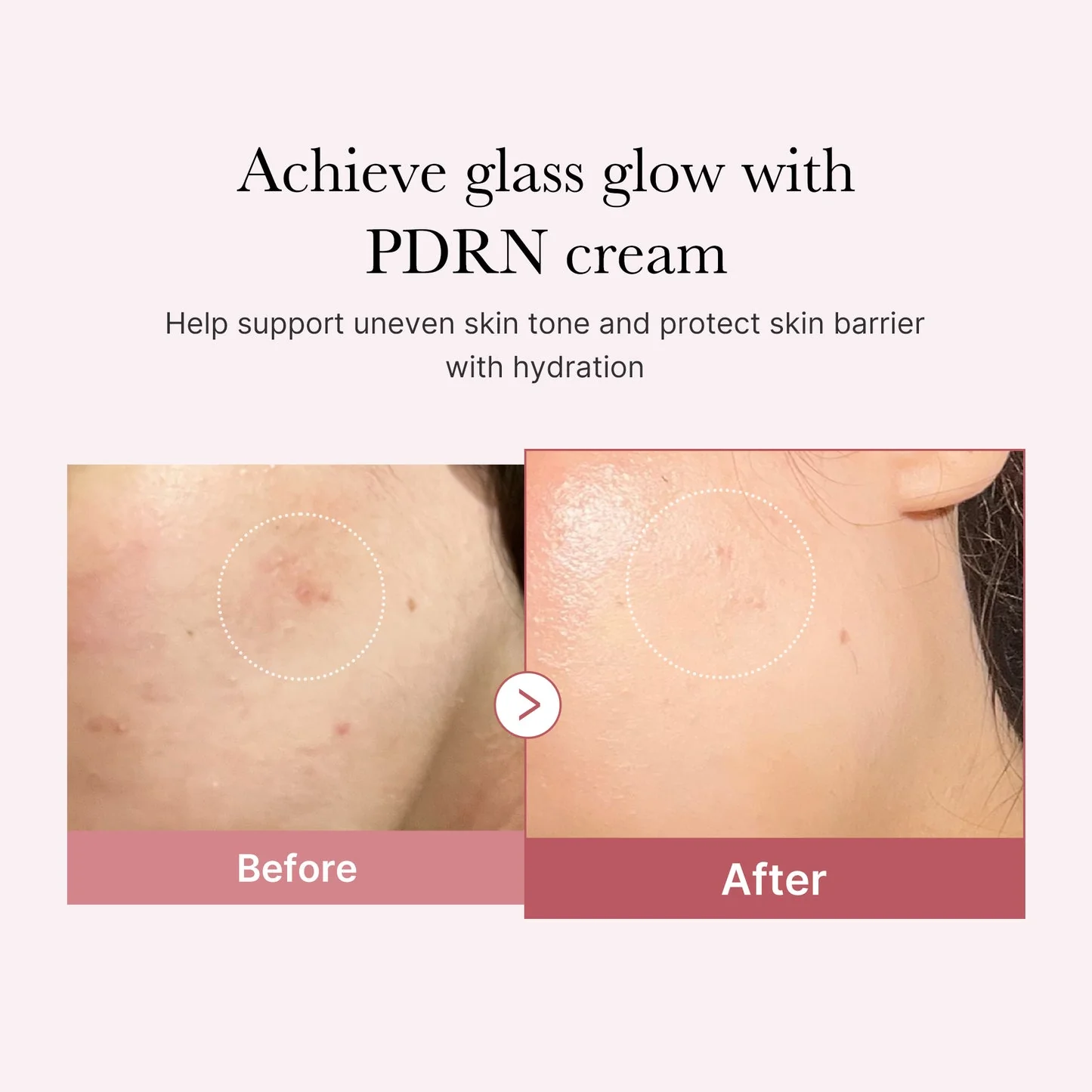 Medicube PDRN Pink Hyaluronic Moisturizing Cream - Image 4