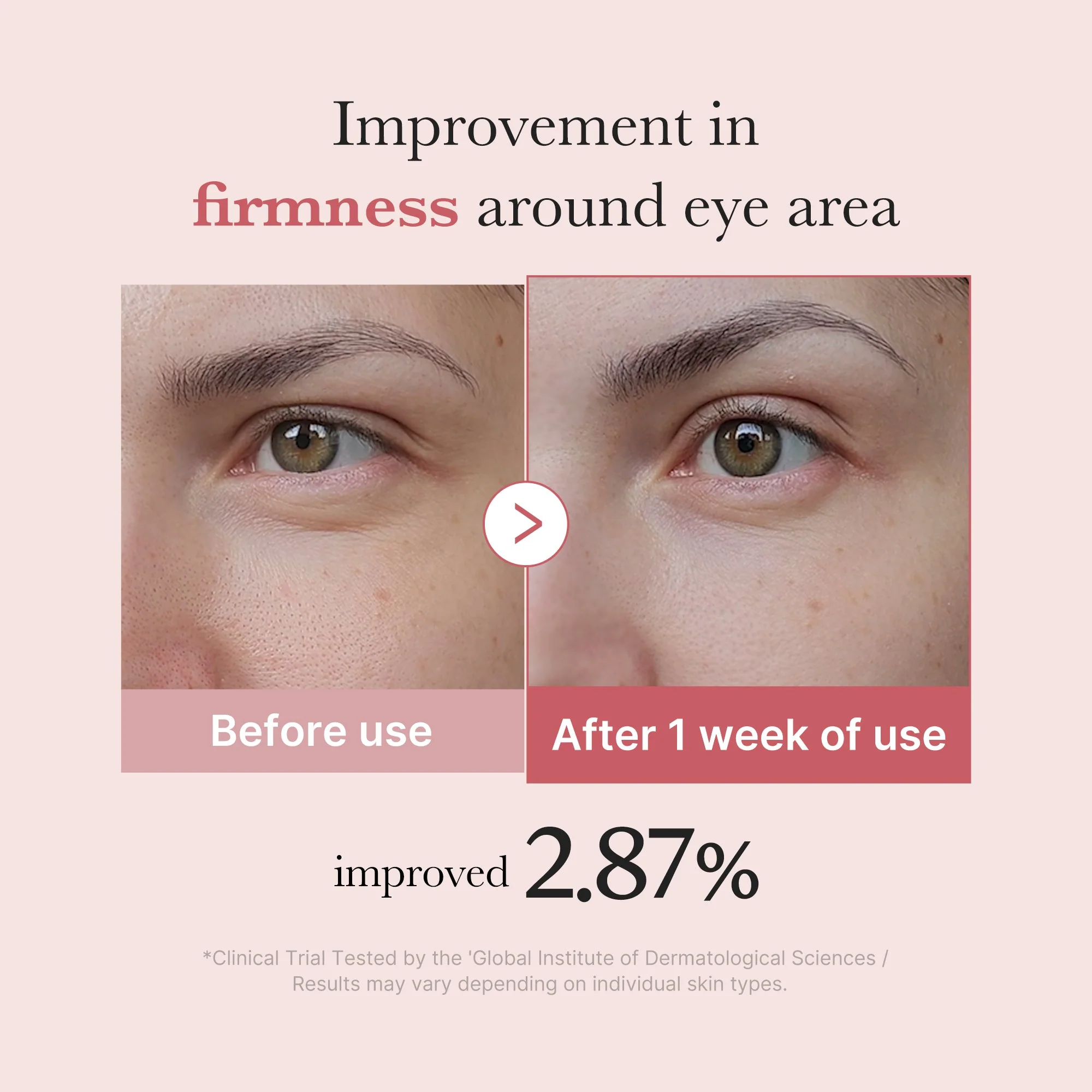 Medicube PDRN Pink Peptide Eye Serum 30ml - Image 4