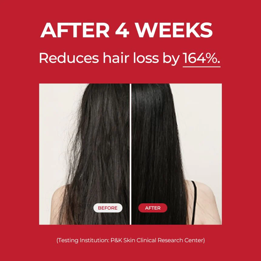 MOEV Annurcatin Hair Tonic 150ml - Image 4